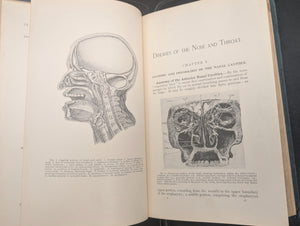 Diseases of the Nose and Throat; Diseases of the Digestive Canal (Illustrated American Edition), 1909 🩺📚🔬